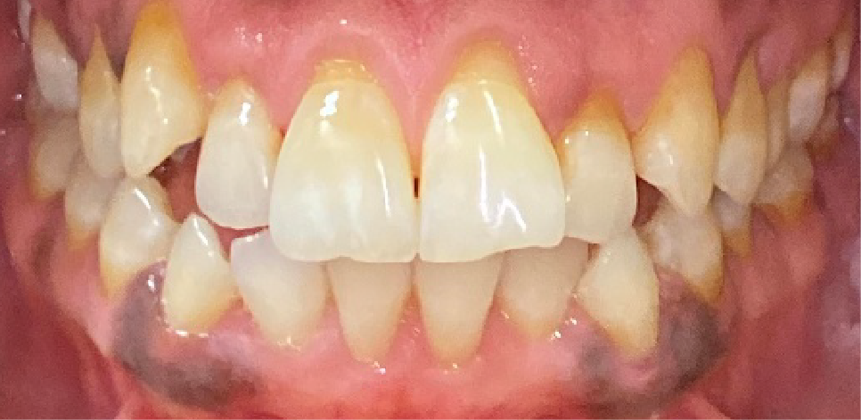 Ottawa Dental Care - Before and after