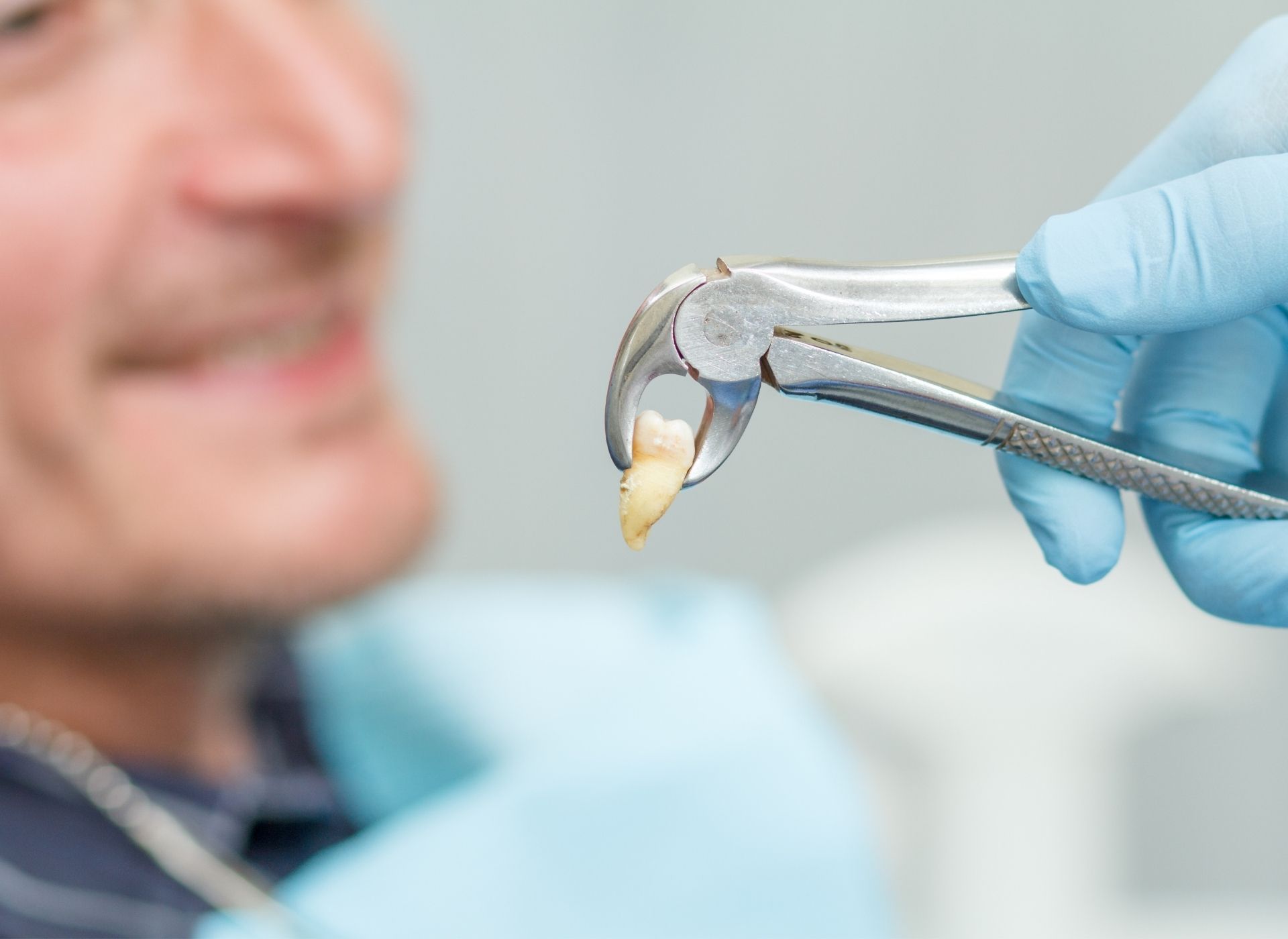 A gloved hand holds dental forceps with an extracted tooth in front of a person sitting in a dental chair.