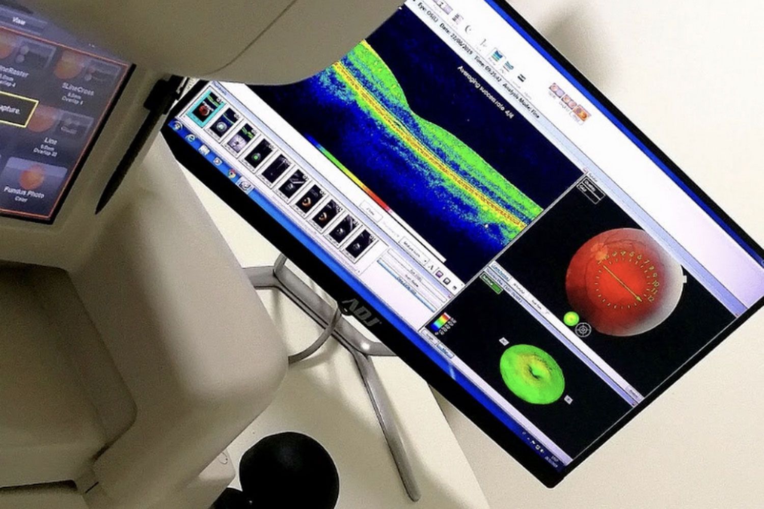 esami strumentali per la vista