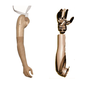 Próteses membros superiores