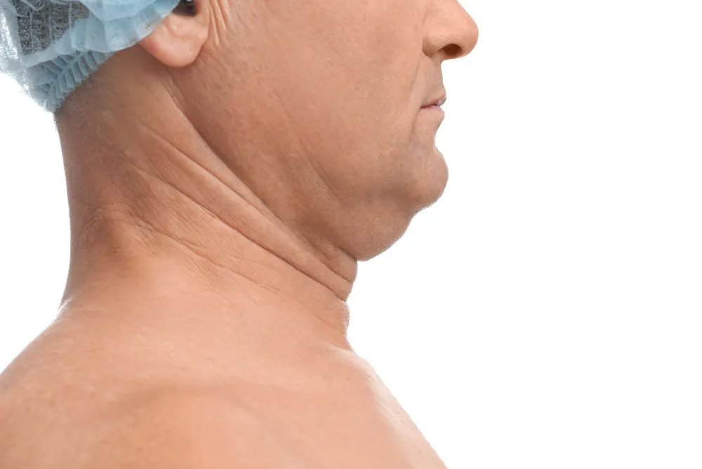 A man with a double chin is wearing a surgical cap.