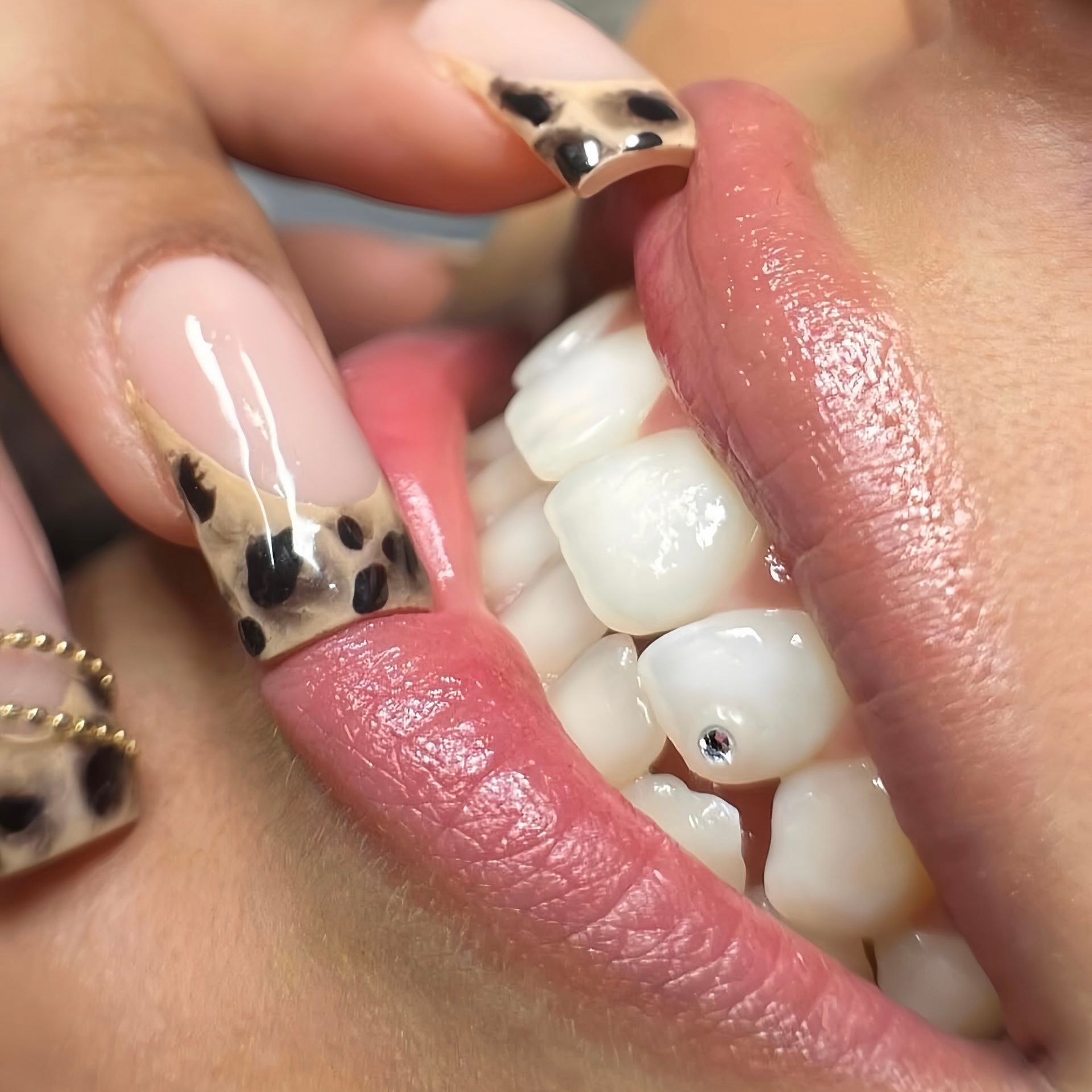 Nahaufnahme des Mundes einer Person mit strahlend weißen Zähnen, einem Zahnschmuck und mit einem Leopardenmuster lackierten Nägeln.