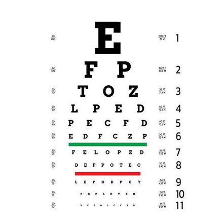 esame della vista