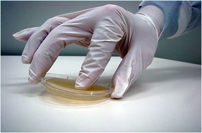 Contact plate being used to collect bacteria on the surface