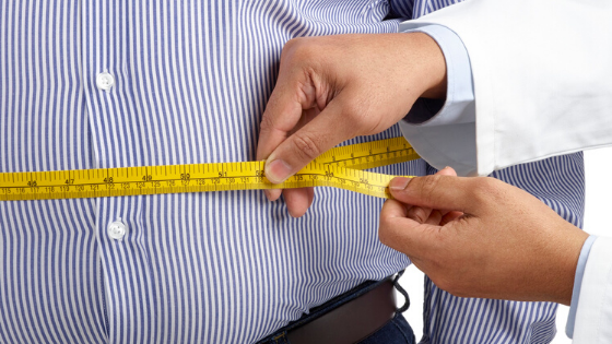 obese man being measured