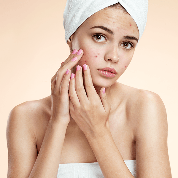 Acne Treatment - NewSkin Laser Center