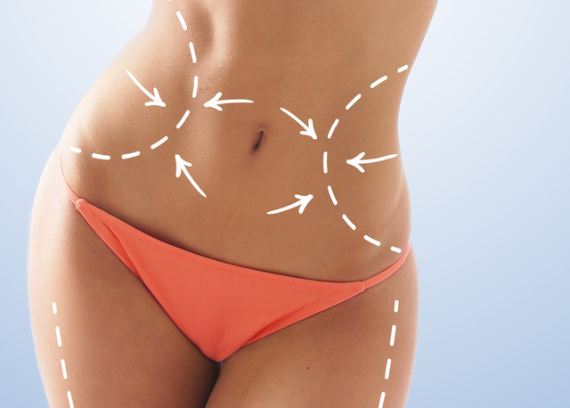Liposuction cost, prices and specials in California