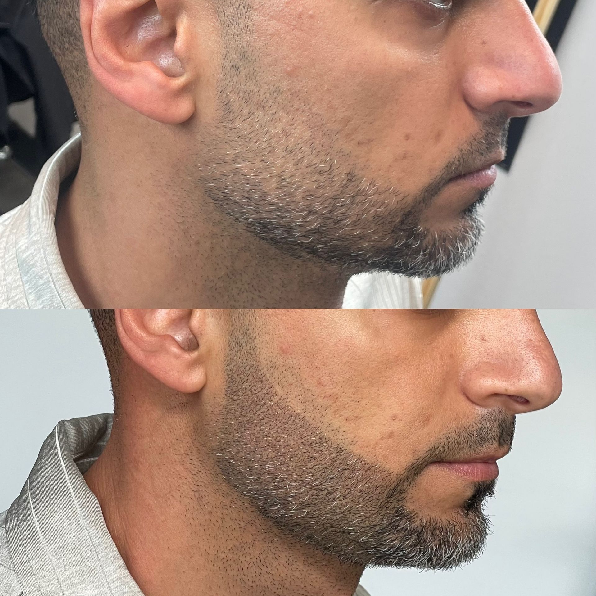 Comparison of a man's beard before and after grooming; shows a sharper, more defined beard.