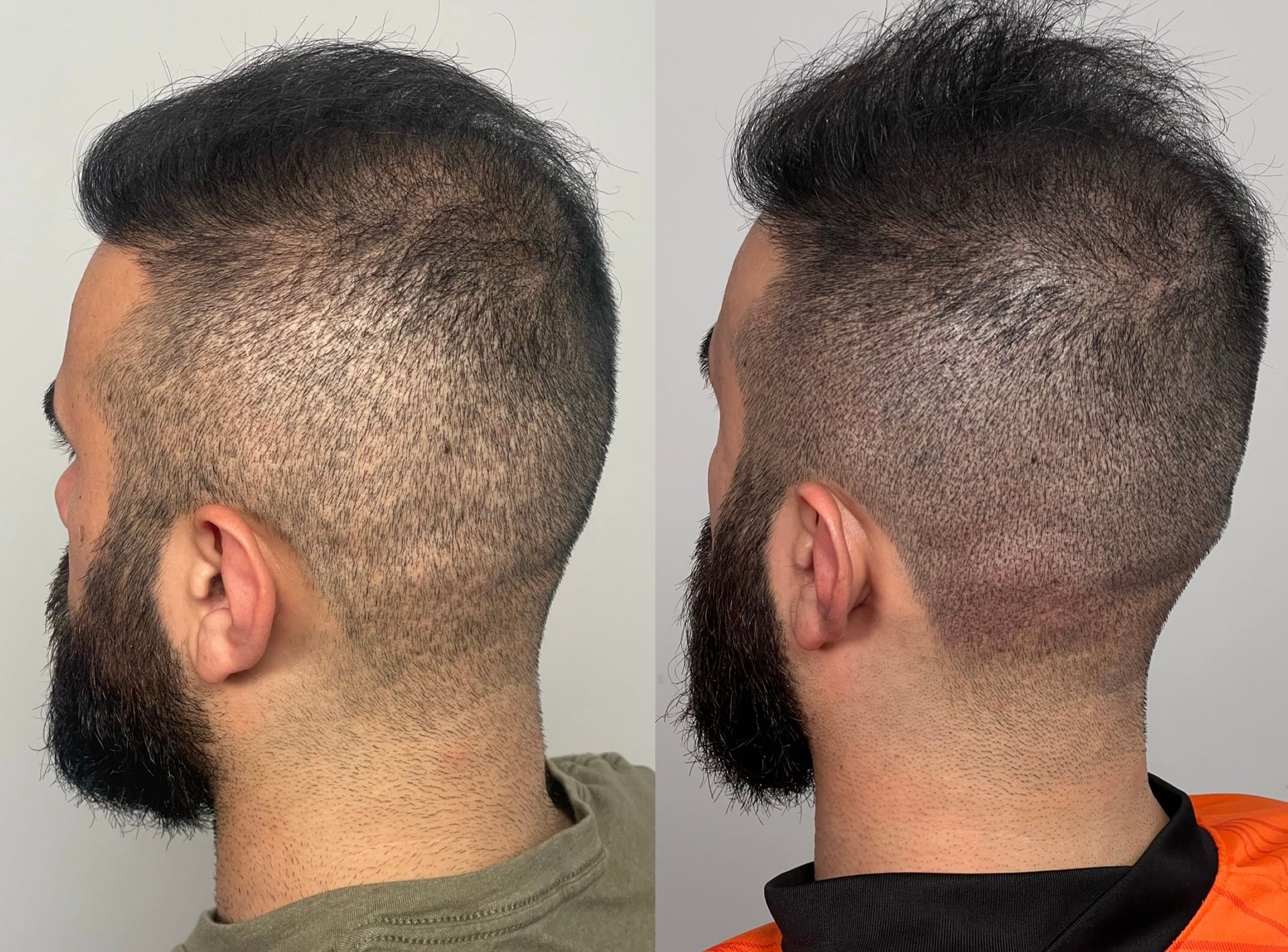 Two side-profile views of a man with a faded haircut, dark hair, and a beard. The hair is styled upward.