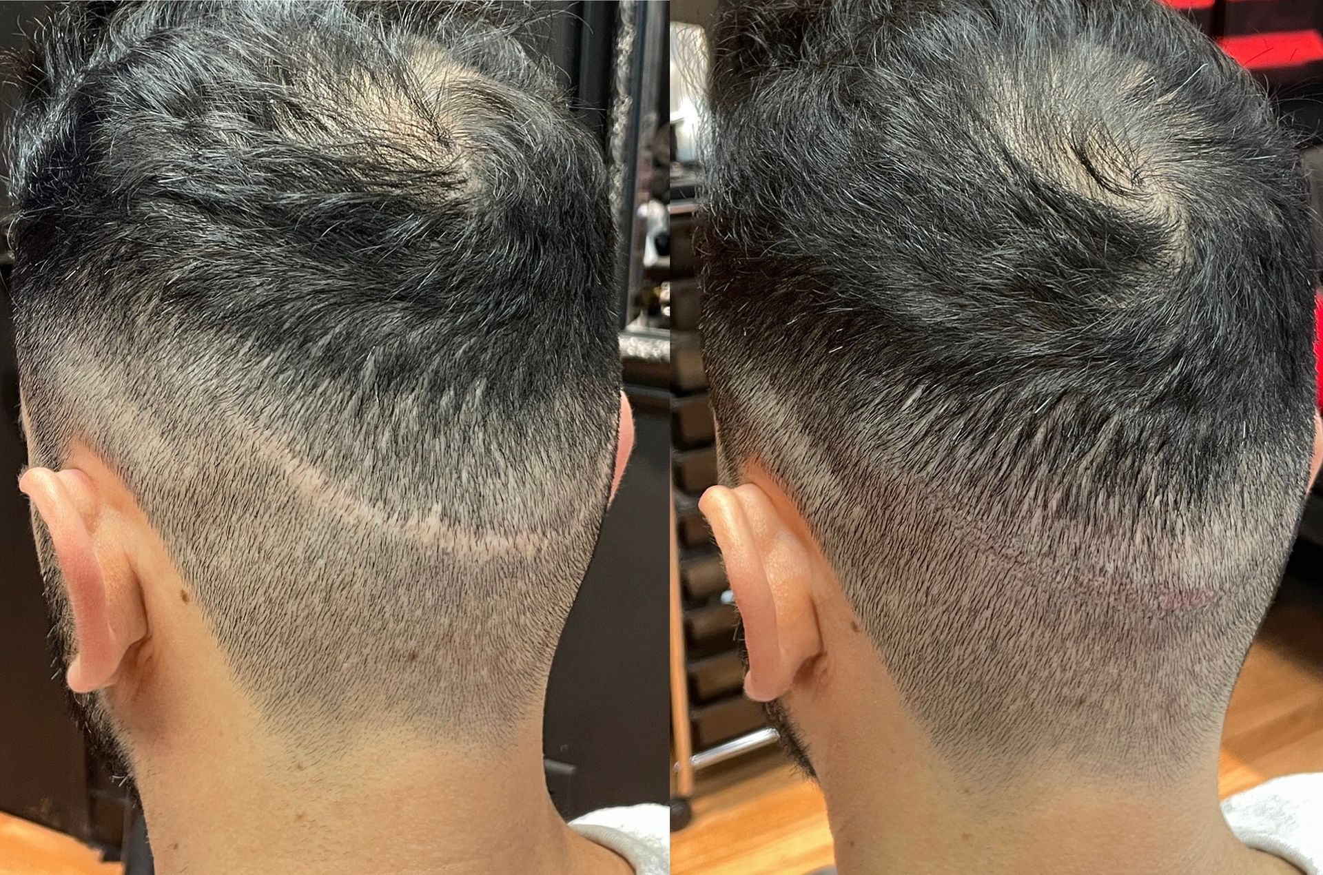 Two rear views of a person's head, showing a fade haircut. The hair is dark and short on top and fades to a shaved nape.