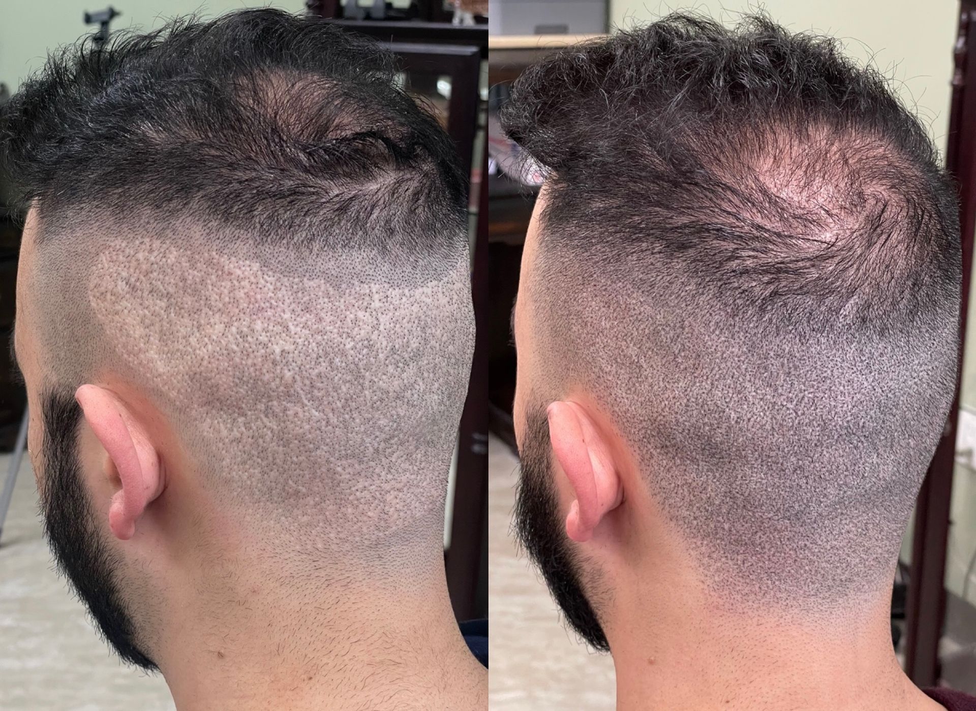 Side-by-side view of a man's head, showing a haircut with a shaved back and sides, fading into longer hair on top.