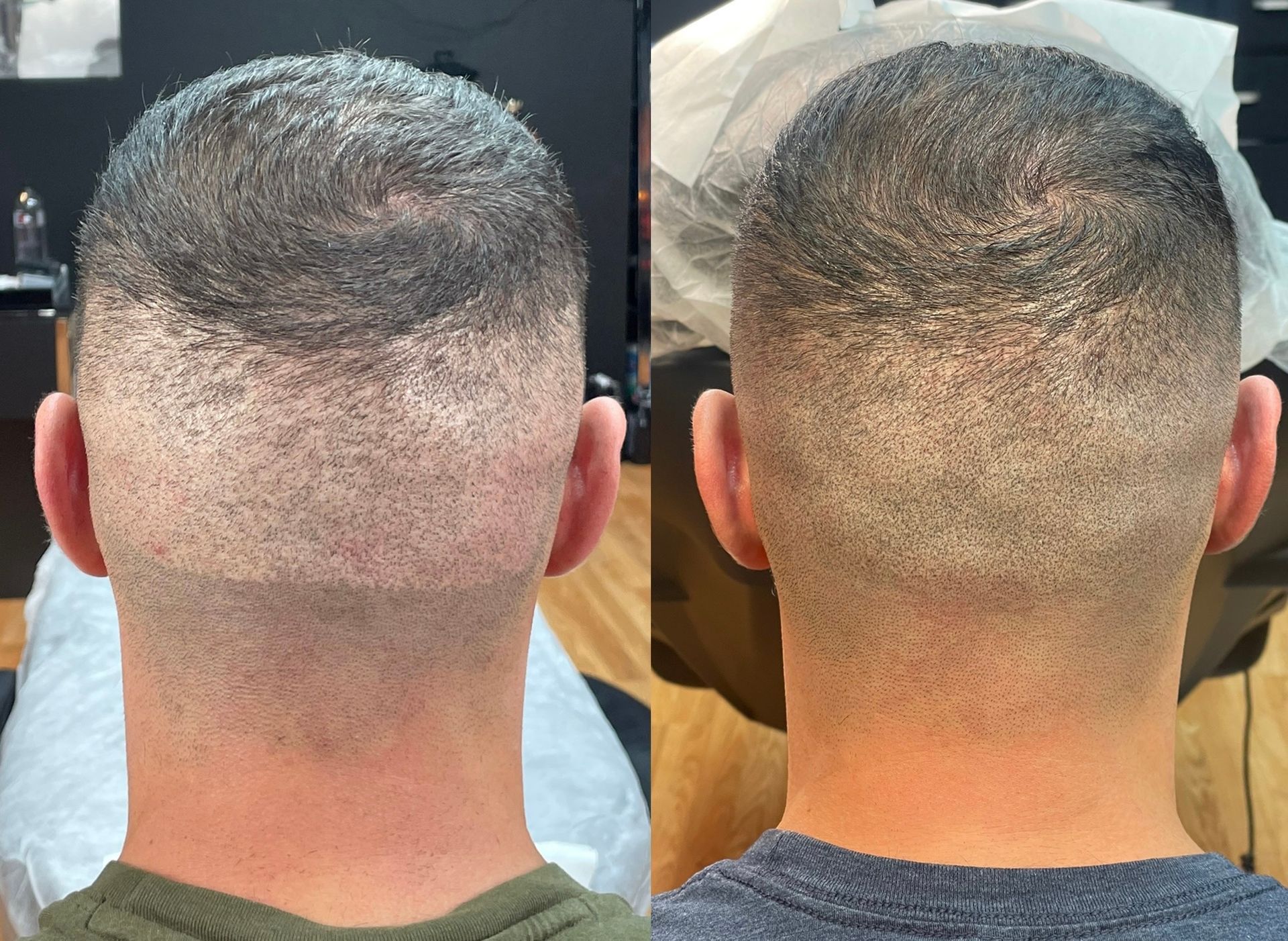 Two views of the back of a person's head, before and after a haircut. The hair is buzzed very short.