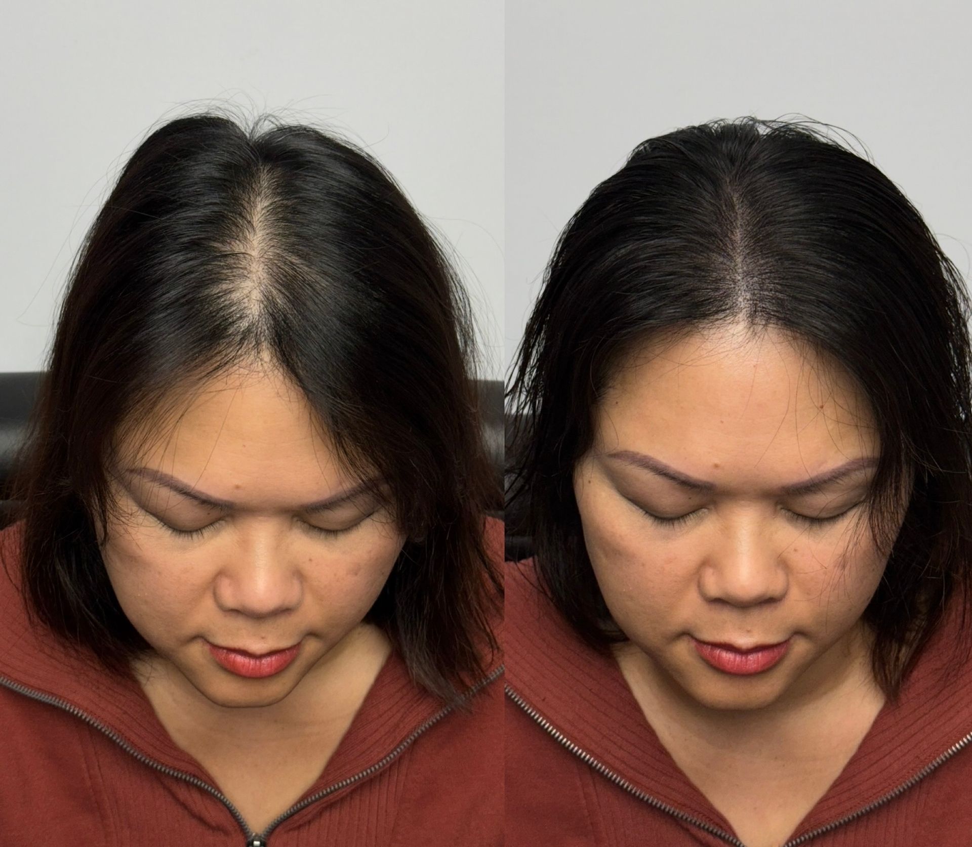 Two side-by-side photos show a woman's hair part. The left image has sparse hair; the right image shows thicker hair.