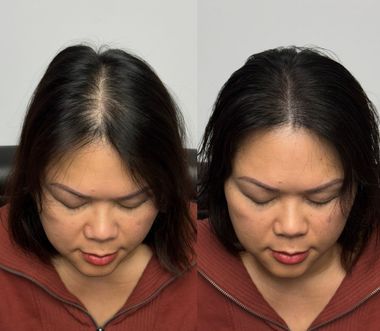 Woman with dark hair, before and after view. Hair appears thicker in the 