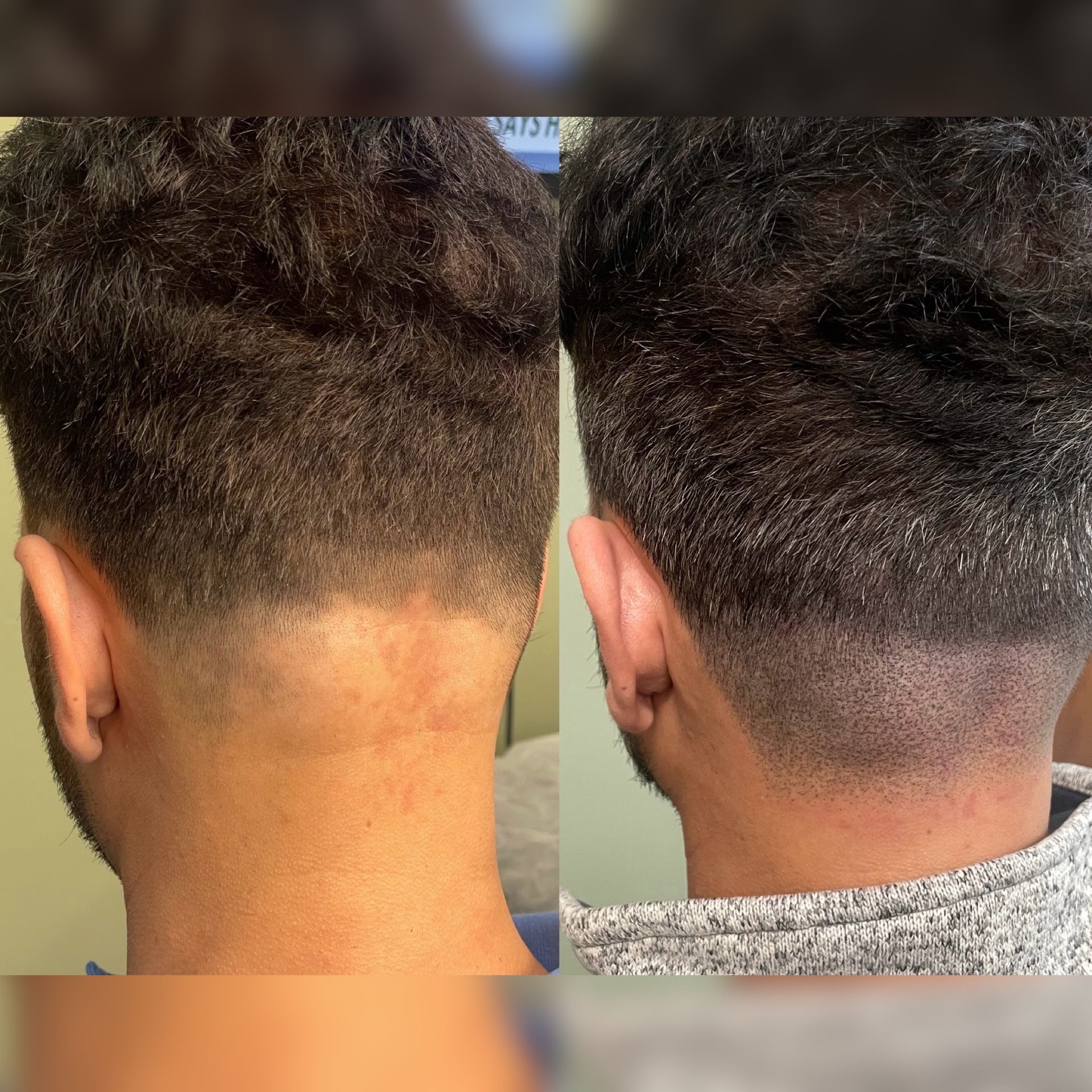 Comparison of the back of a person's head: before (left) and after (right) a haircut, showing a cleaner neckline.