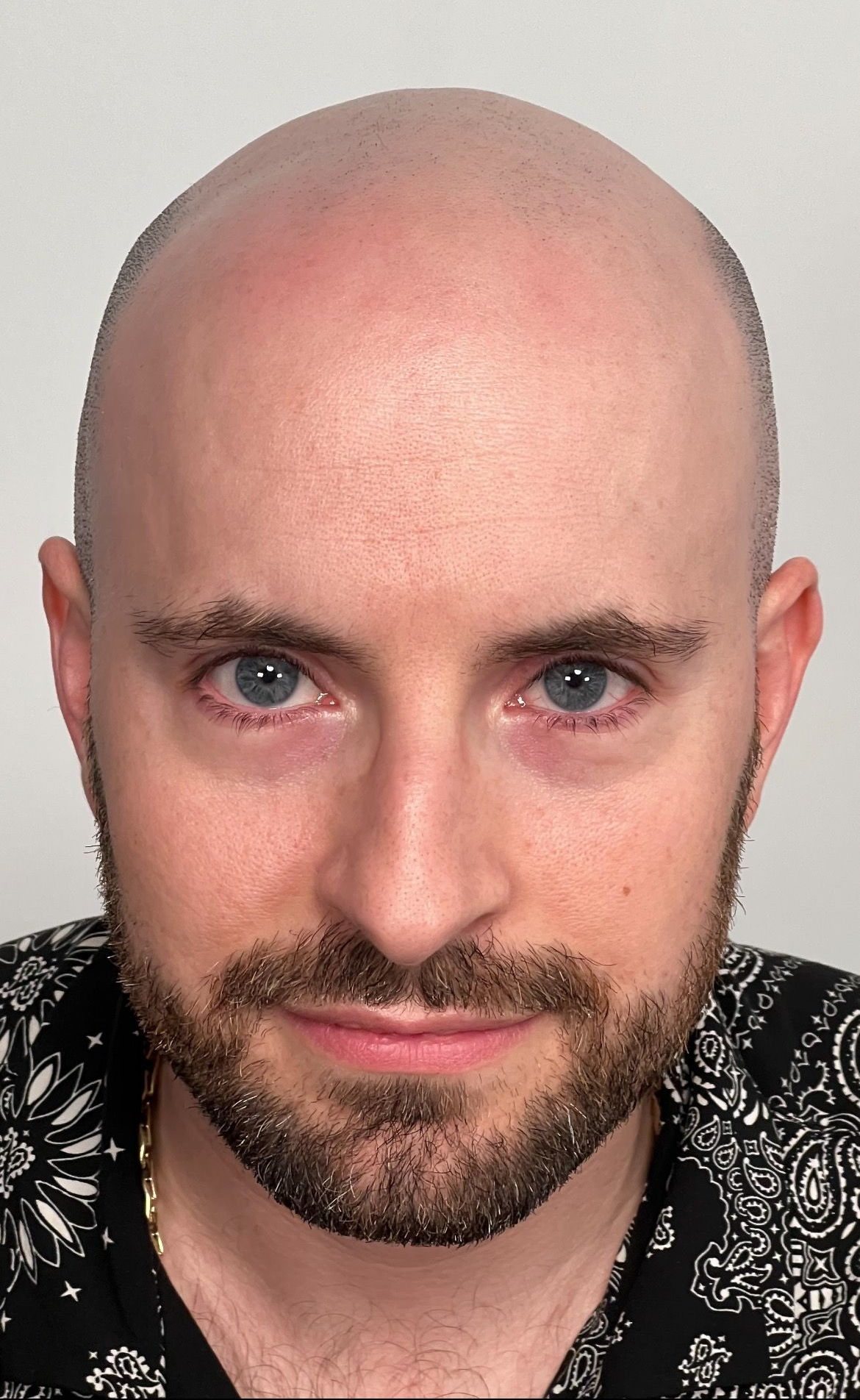 Bald man with blue eyes and a short beard, wearing a black patterned shirt, looking directly at the viewer.