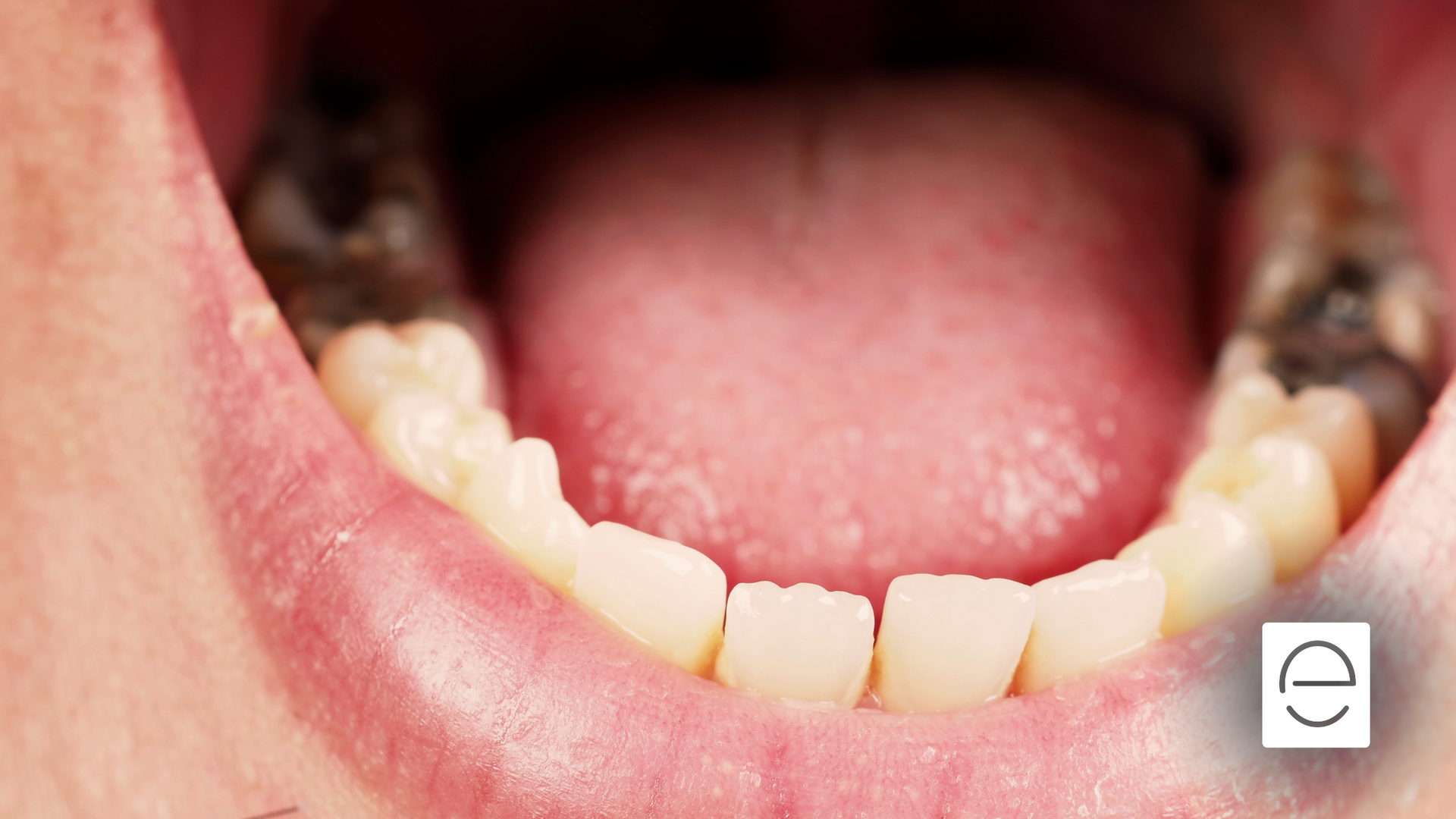 A close up of a person 's mouth with their teeth showing.