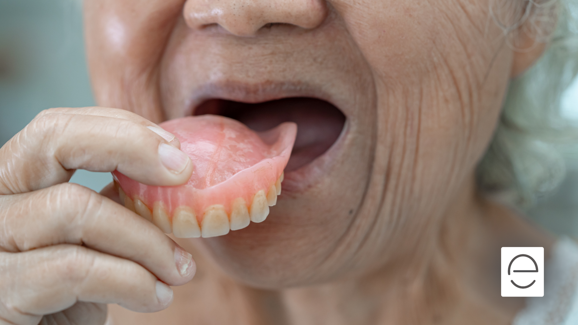 An elderly woman is holding a denture in her mouth.