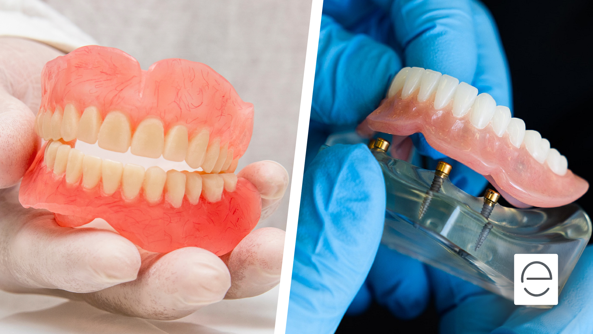 A person is holding a denture next to a model of a denture.