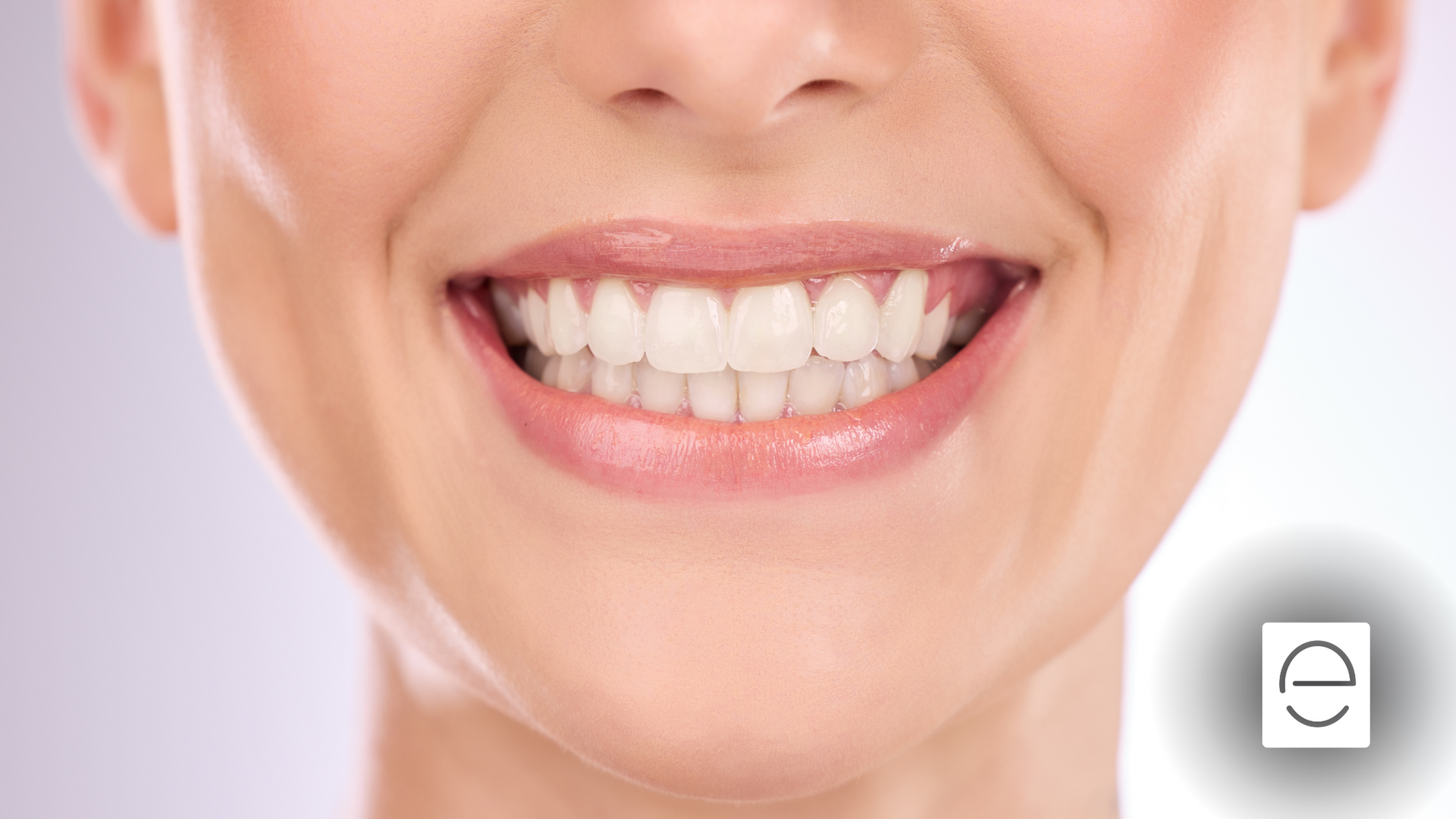 A close up of a woman 's smile with white teeth