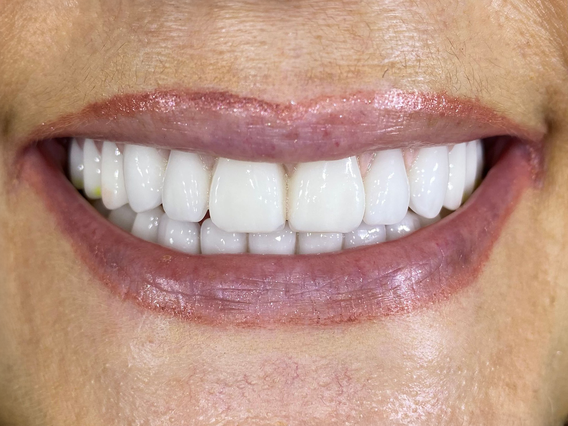 Close-up of a smiling mouth with white teeth and mauve lipstick