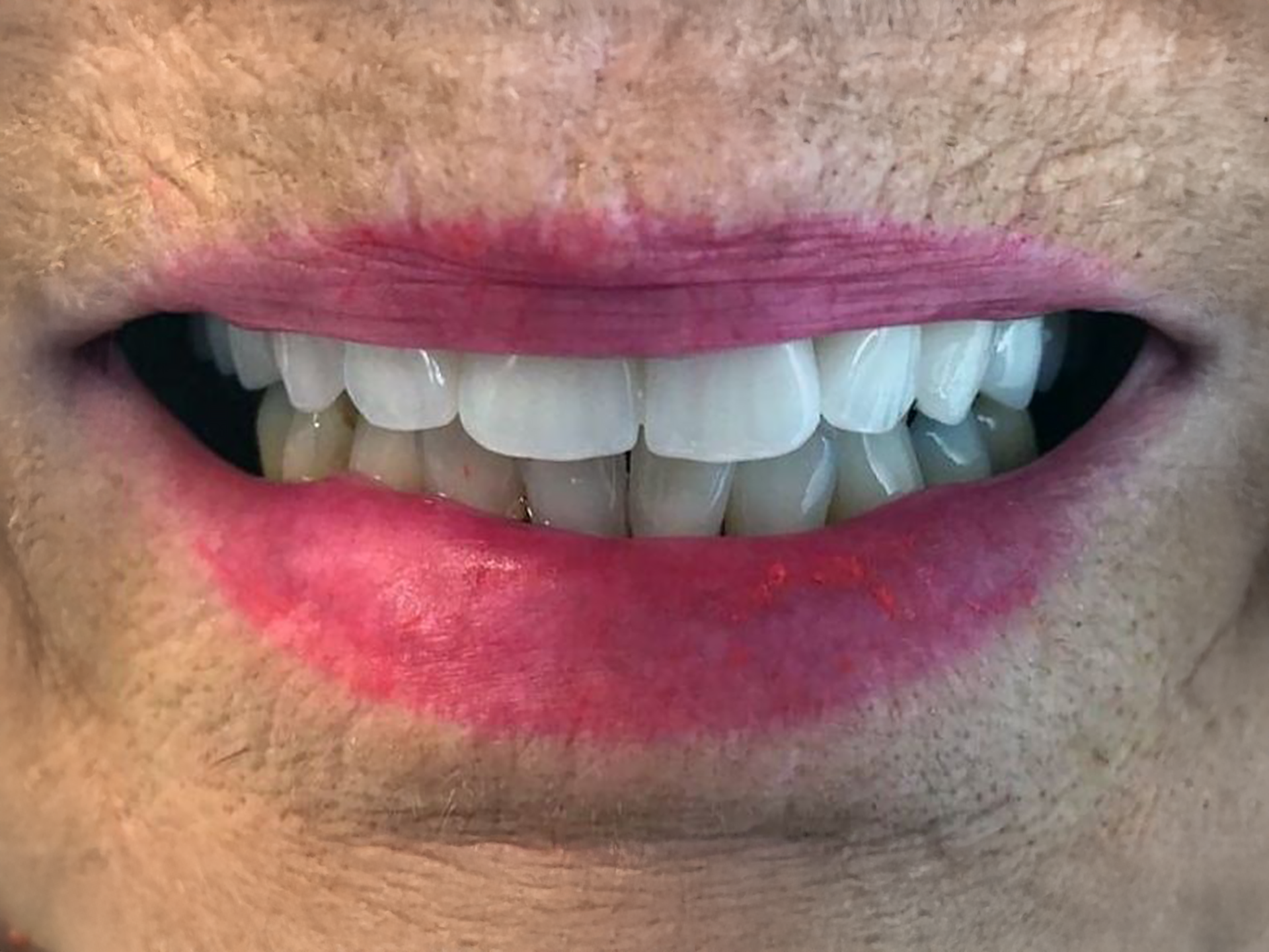 Close-up of a smiling mouth with pink lipstick and visible teeth