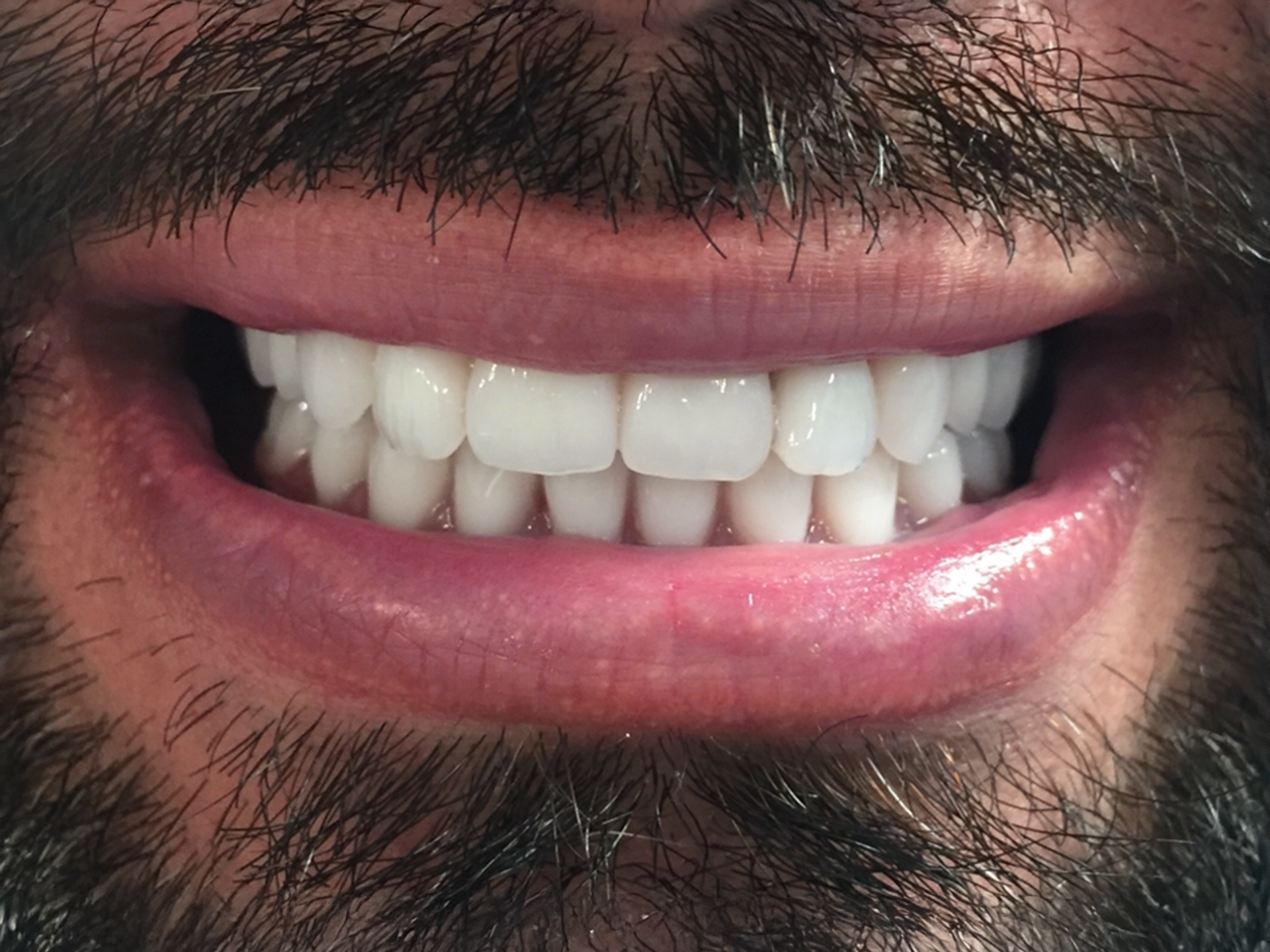 Close-up of a smiling mouth with white teeth and trimmed facial hair