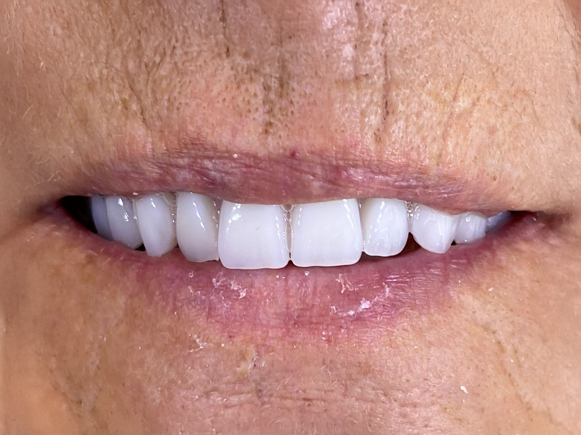 Close-up of a smiling mouth with bright white teeth and pink lips