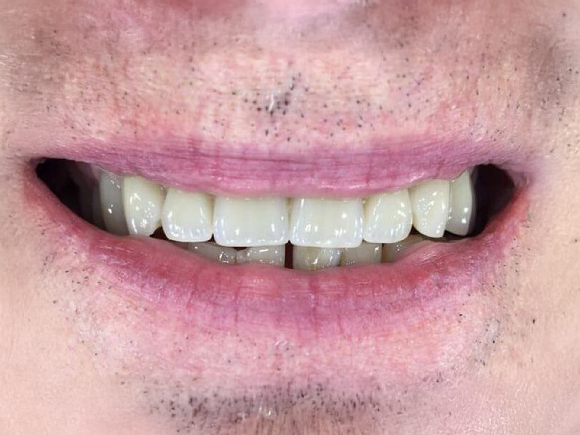 Close-up of a smiling mouth with white teeth and pink lips