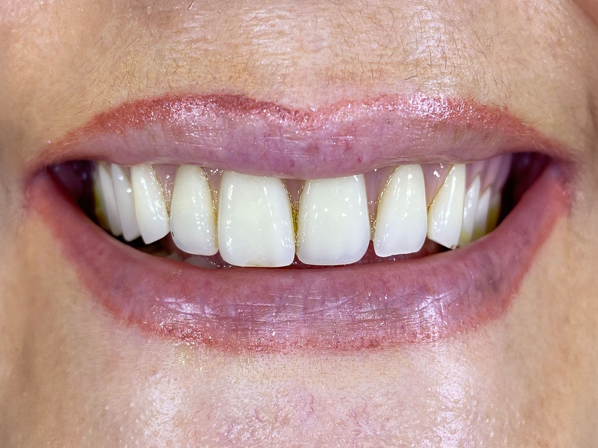Close-up of a smiling mouth showing white teeth and pink lips.