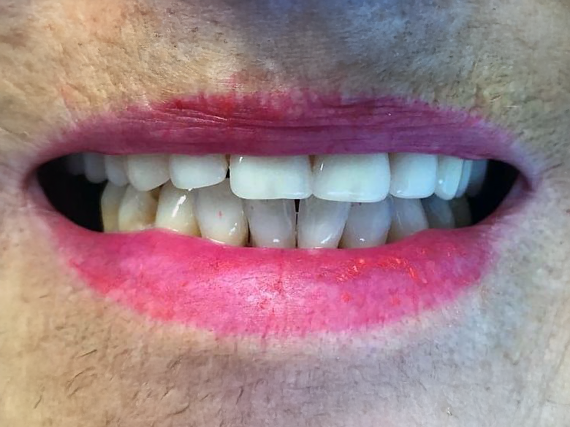 Close-up of a smiling mouth with white teeth and bright pink lipstick