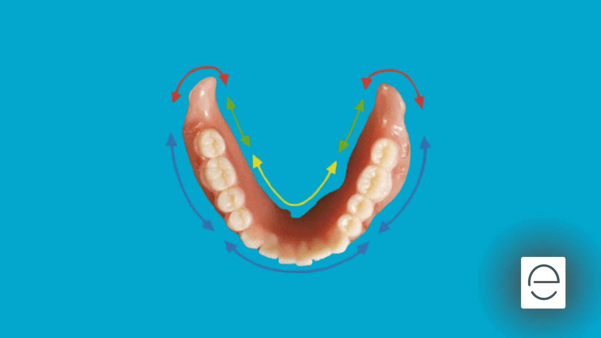 Discover Lower Suction Dentures at Envision Denture and Implant Centre