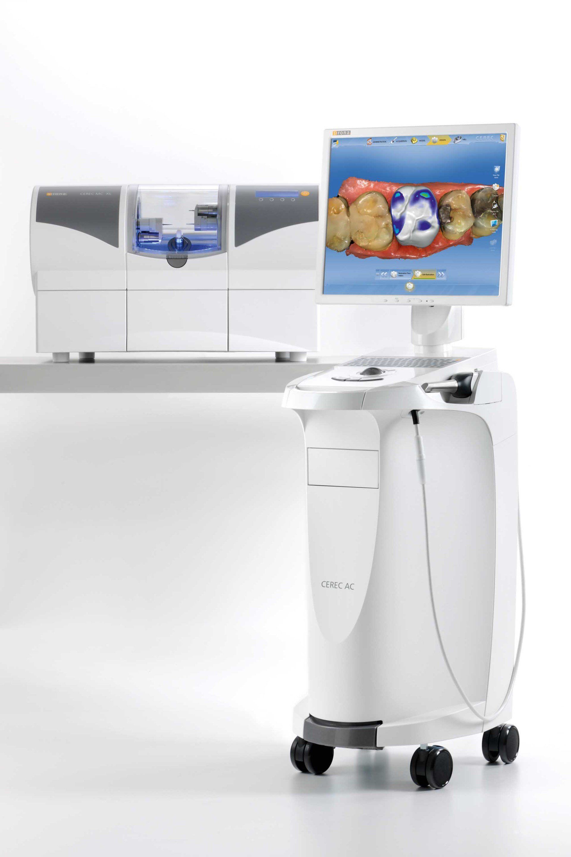 realizzazione di apparecchio dentale con tecnologia digitale