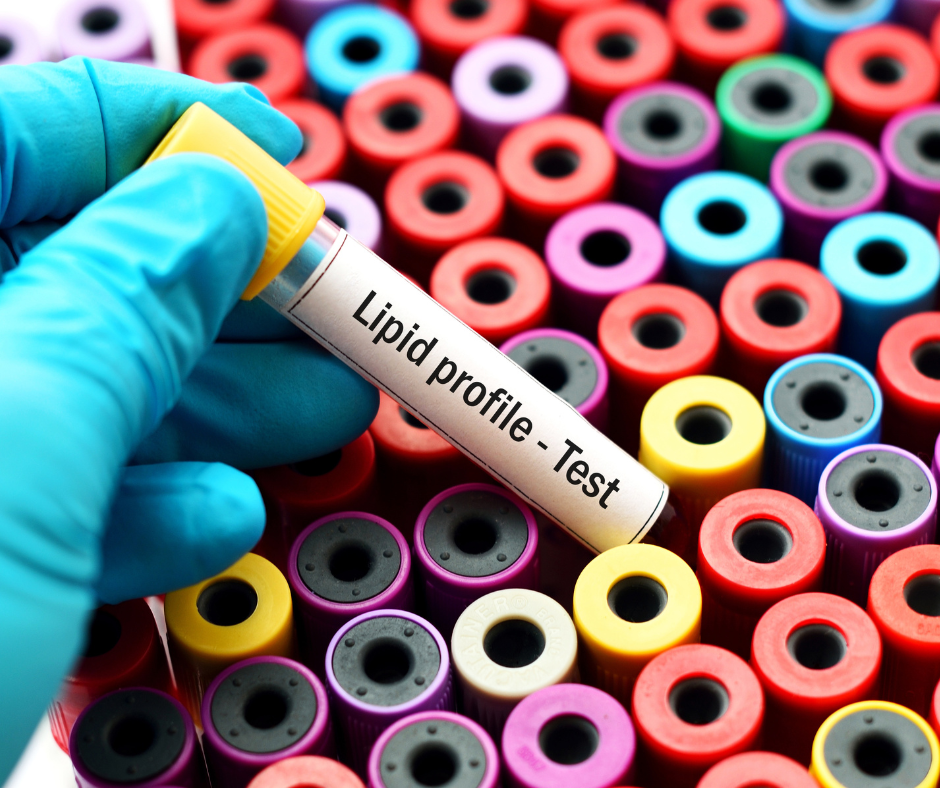 Advanced Lipid testing | The Lipid Clinic