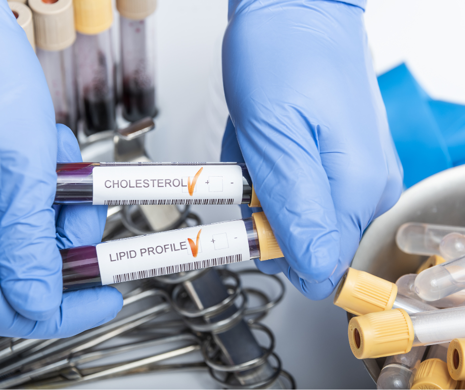 Comprehensive Assessment of Metabolic and Cardiovascular Health | The Lipid Clinic