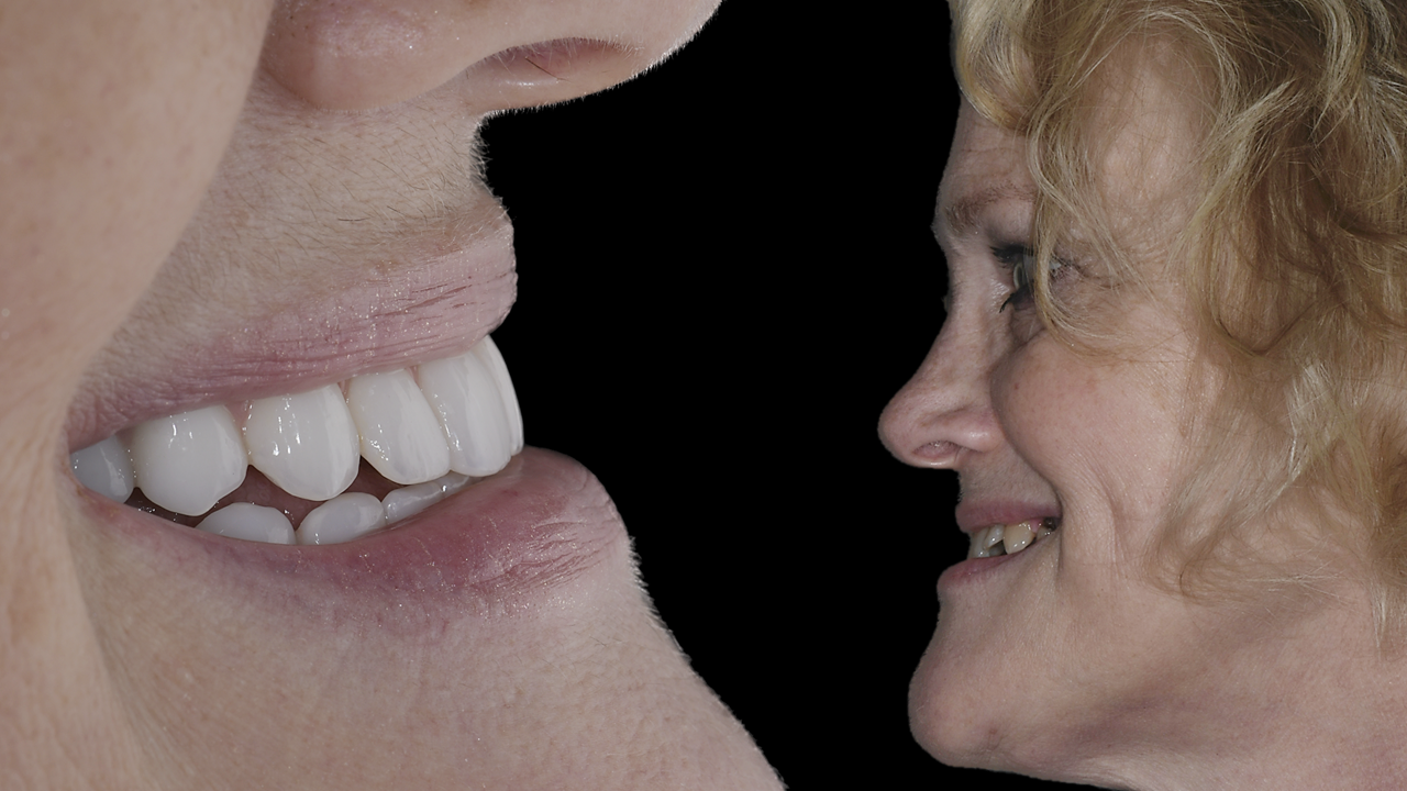 Two people, profiles facing each other. One with bright white teeth, the other smiling with aged features.