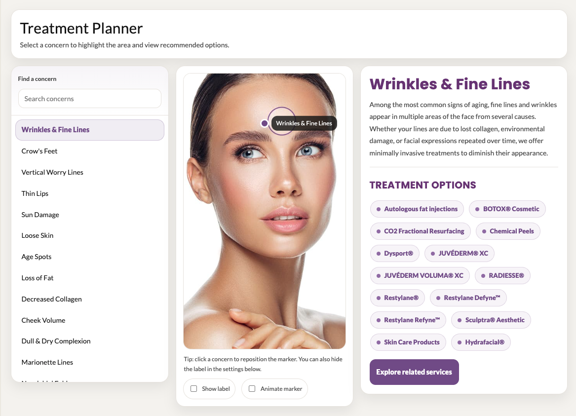 Treatment planner showing a woman with highlighted areas for wrinkle treatment options.