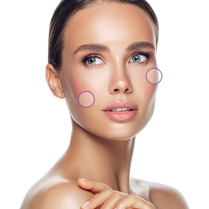 Treatment planner model showing loss of fat areas