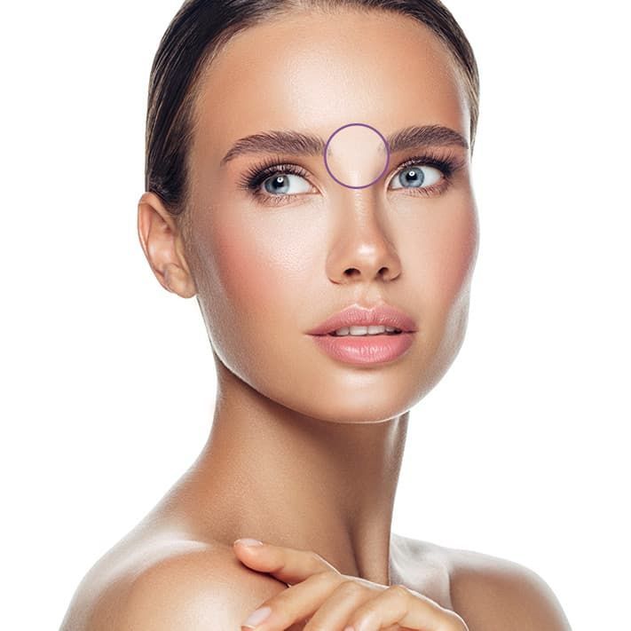 Treatment planner model showing worry line area