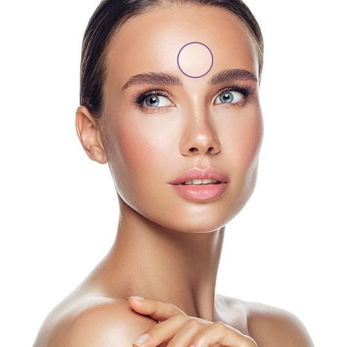 Treatment planner model showing wrinkle area