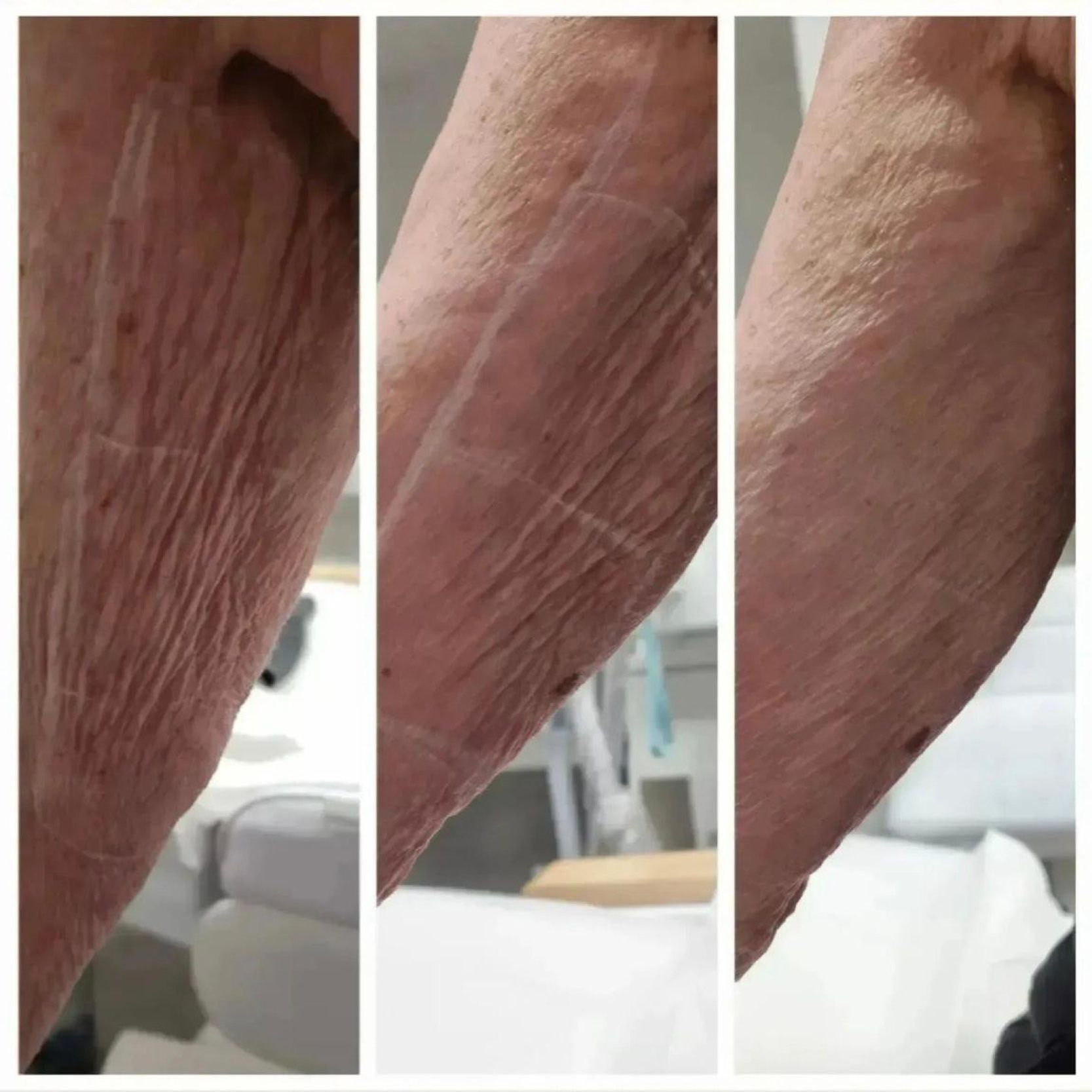 Ein Vorher-Nachher-Foto vom Hals und der Brust einer Frau.