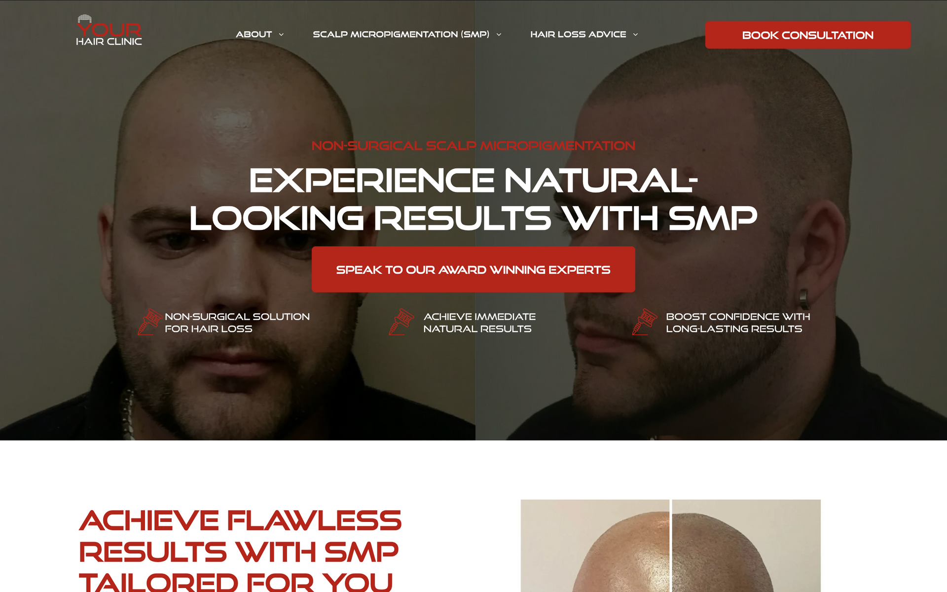Your Hair Clinic Service-Based Bespoke Website