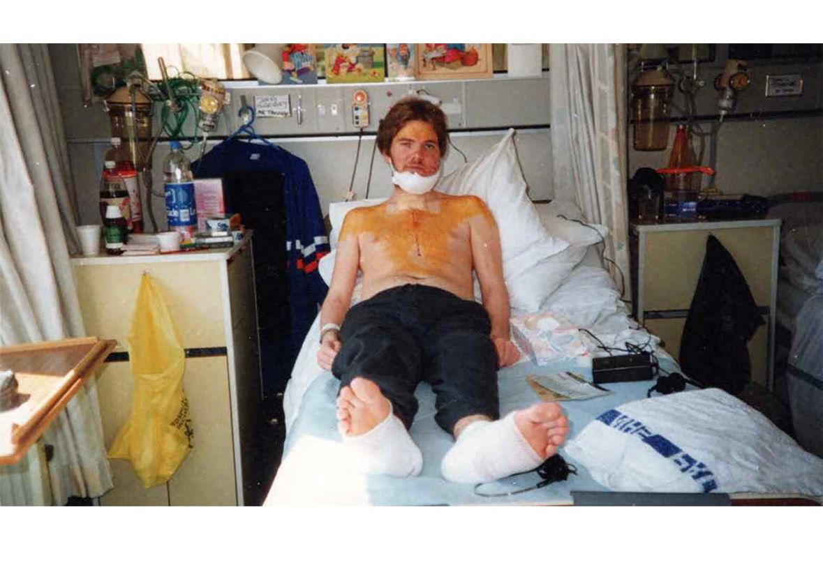A man in a hospital bed with injuries.