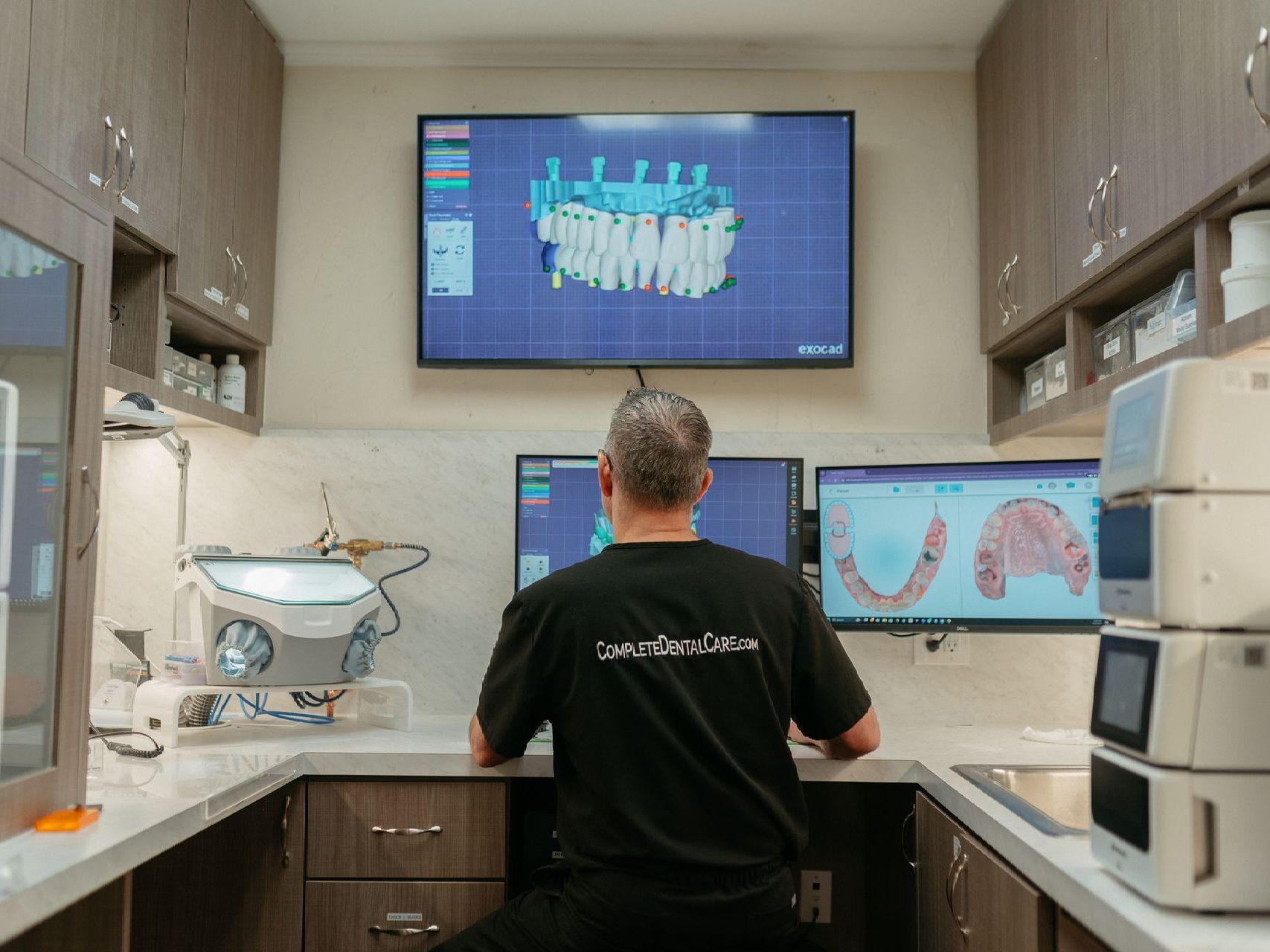 Exocad digital design