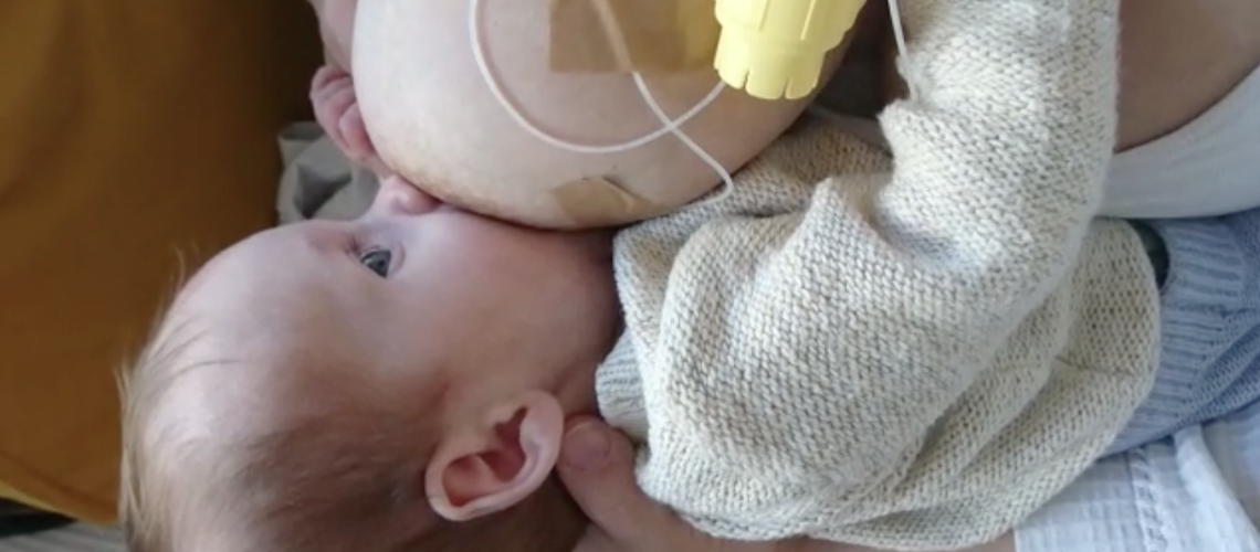 uso de sistema de suplementación al pecho SNS en relactación