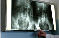 Looking Over X-rays