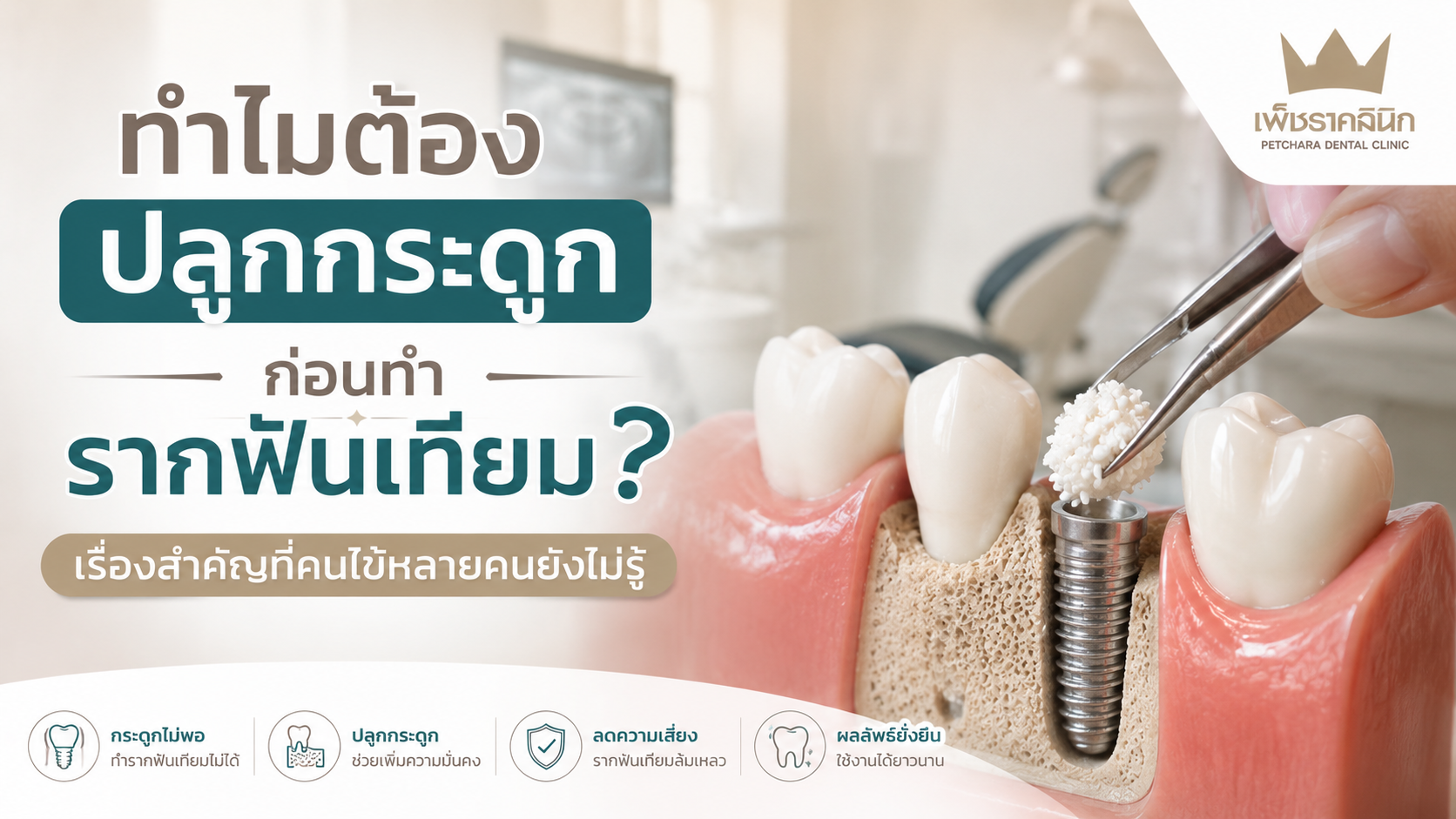 why-bone-graft-before-dental-implant