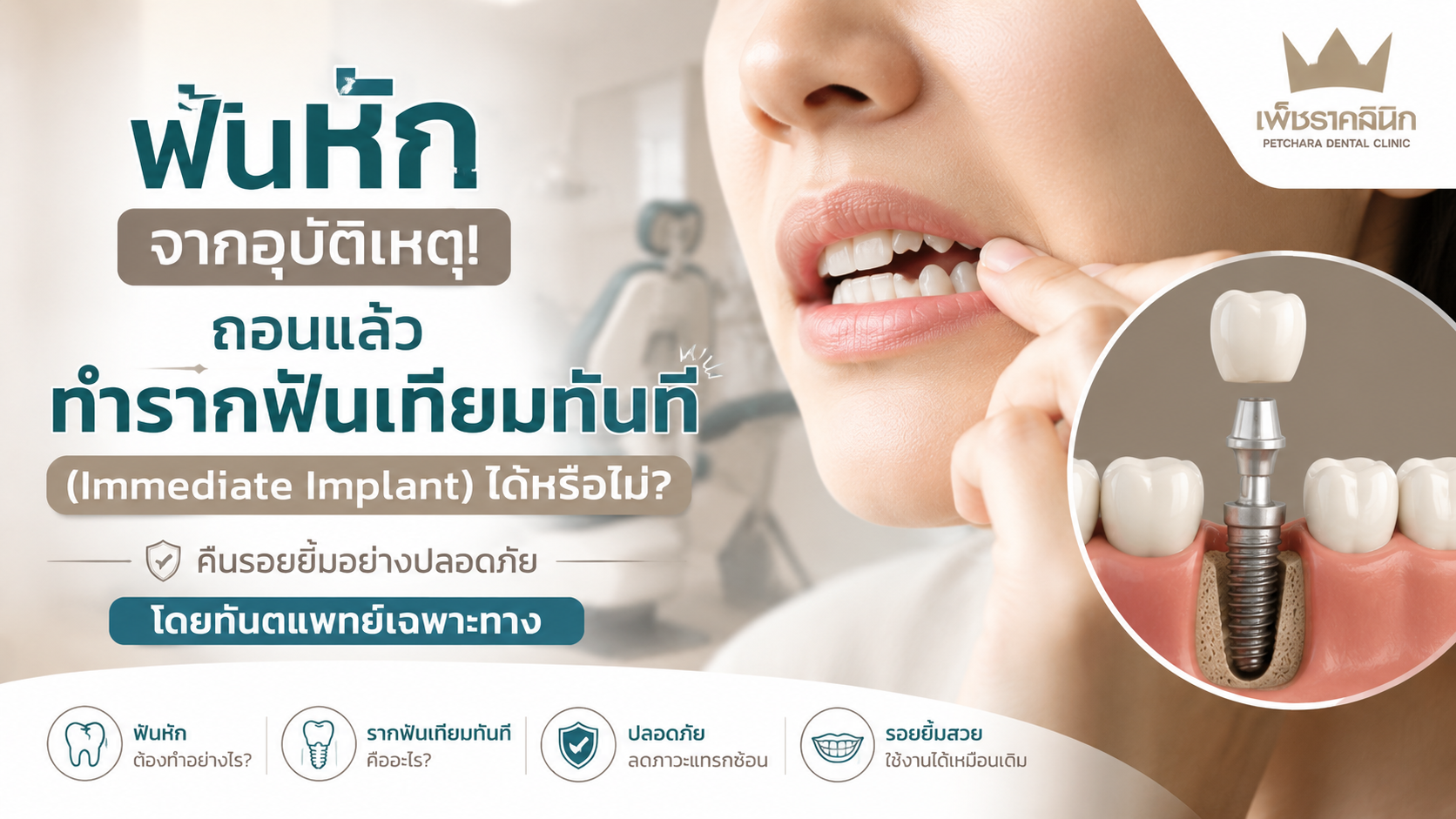 immediate-dental-implant-after-accident