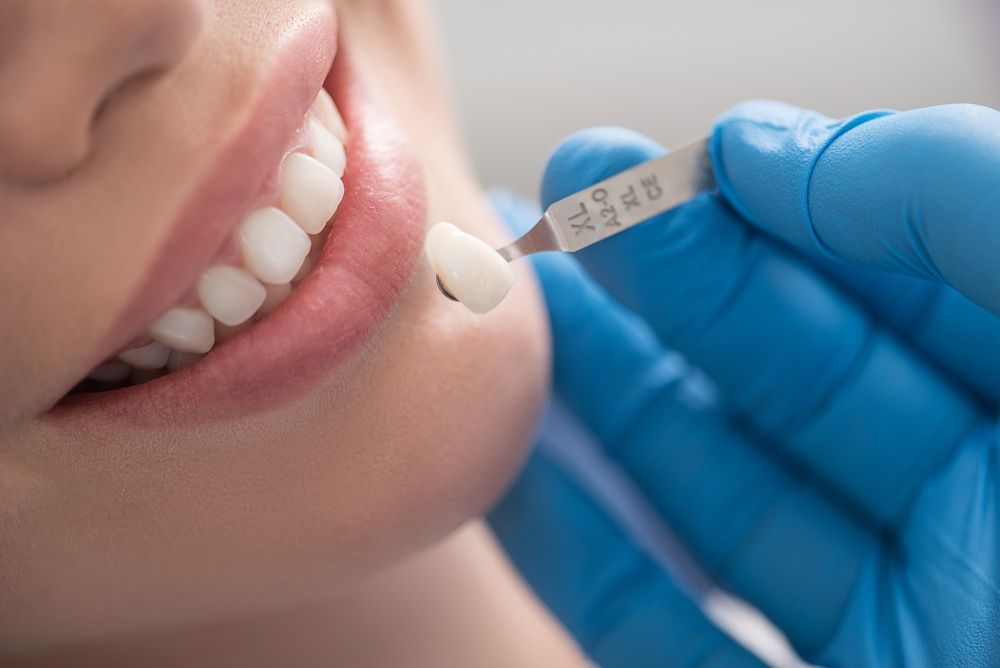 dental-crown-pain-care