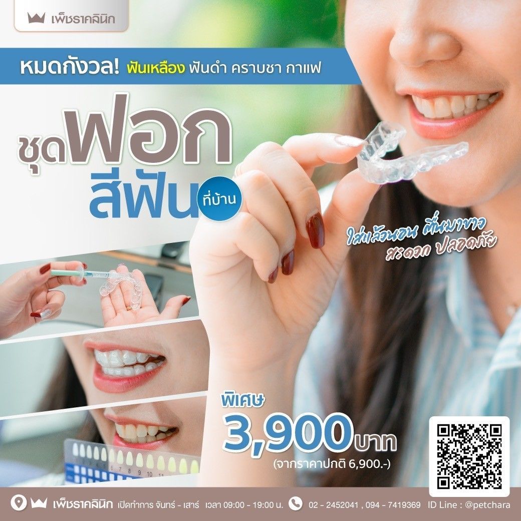 ฟอกสีฟันเองที่บ้าน ปลอดภัยไหม? ดีอย่างไร? บทความนี้มีคำตอบ!